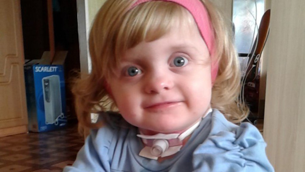 2-летней Полине из Кирова врачи вернули возможность самостоятельно дышать