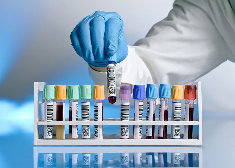 Комплексные лабораторные исследования со скидкой 15% + забор крови в подарок!