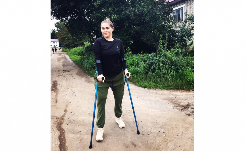 Какого жить без руки. Женщины инвалиды без ног.