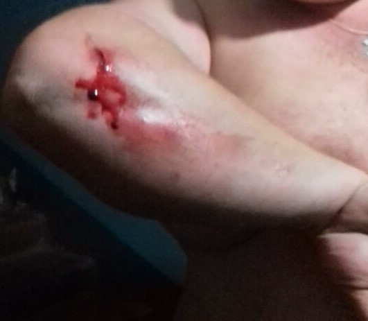 В Кирове мужчина получил ножевое ранение, когда попытался утихомирить  шумного соседа