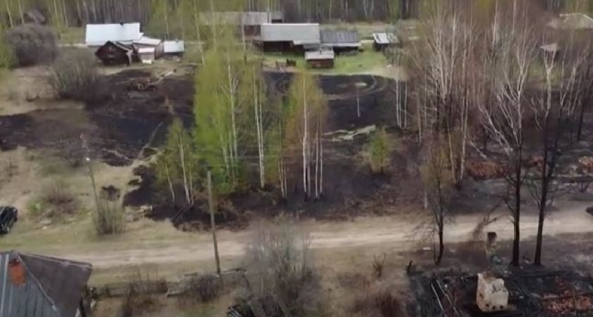Врачи Кировской области борются за жизнь мужчины, который пострадал на пожаре