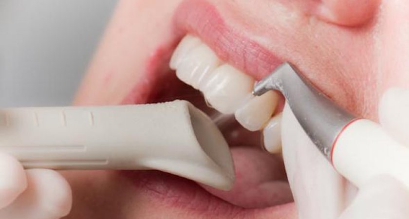 Секрет ослепительной улыбки: где можно сделать профгигиену полости рта по акции