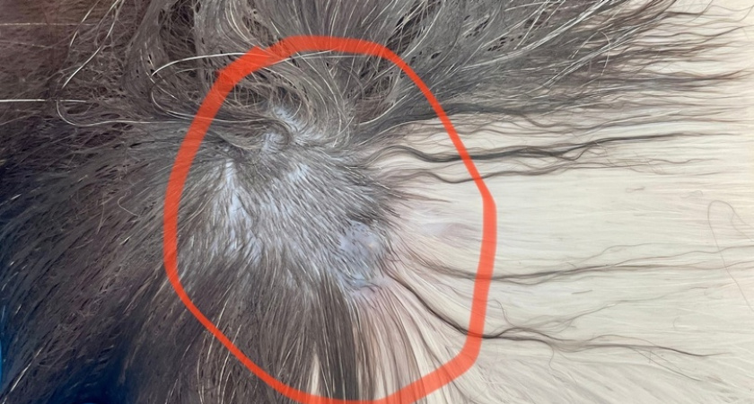 В Кировской области пулю перепутали с клещом