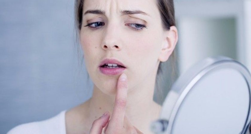 Рецидивирующий герпес: как предупредить обострения