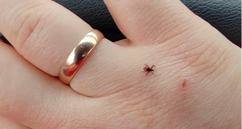 Клещи гибнут молниеносно: копеечное средство защищает лучше всех магазинных аэрозолей