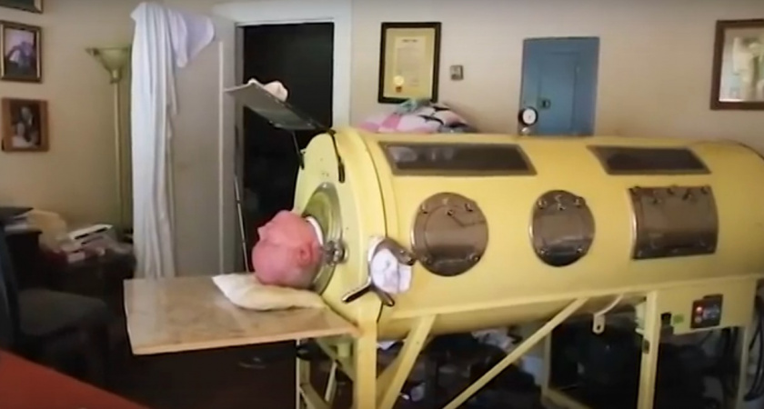 Человек в «железном легком»: история Пола Александера, который на протяжении 68 лет жил в капсуле