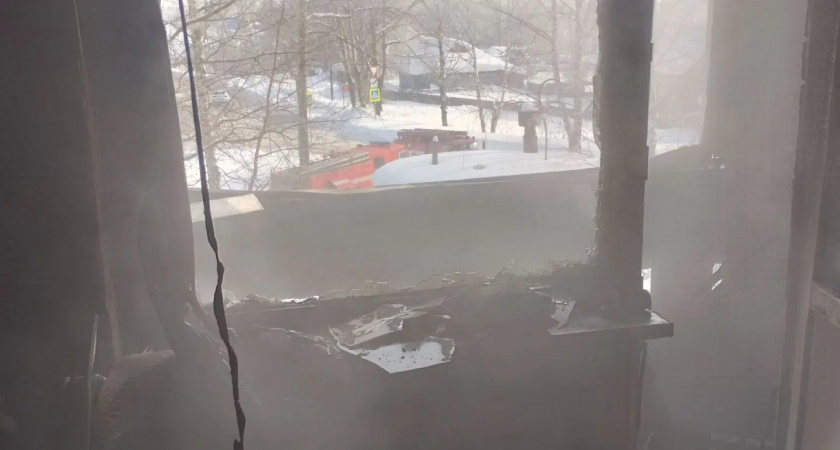 10-летний мальчик госпитализирован после пожара в многоэтажке в Кирове