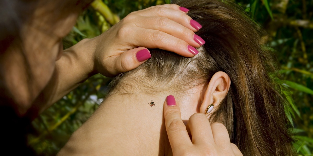 Более 80 человек обратились в центры «Лайт» после укуса клеща