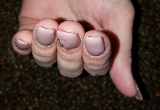 Кровавые ногти и желтые волосы: 9 фото ужасов кировской индустрии красоты