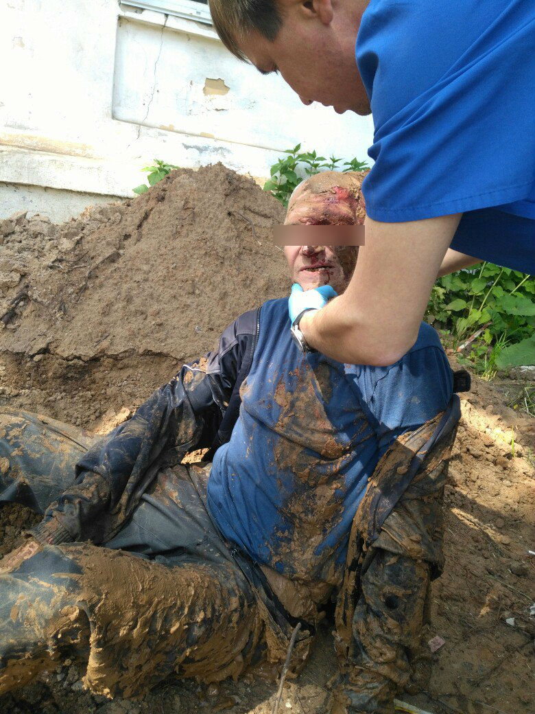 В Кирове в вырытую коммунальщиками яму упал мужчина