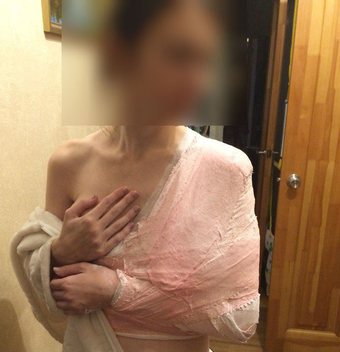 Следователи начали проверку после травмирования кировчанки в транспорте