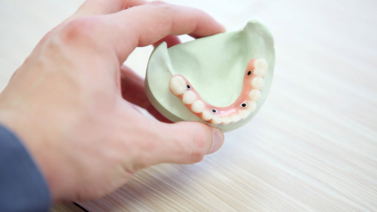Стоматологи разоблачают 4 мифа о протезировании зубов
