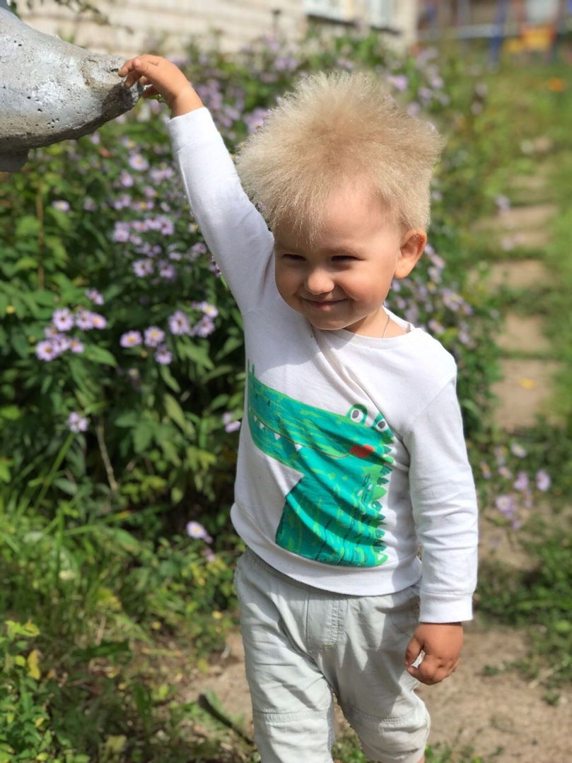 «Таких людей всего 100 в мире»: история малыша из Кирова с уникальными волосами