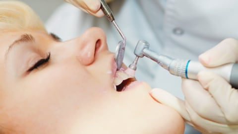 Кровоточивость десен: почему стоматологи бьют тревогу?