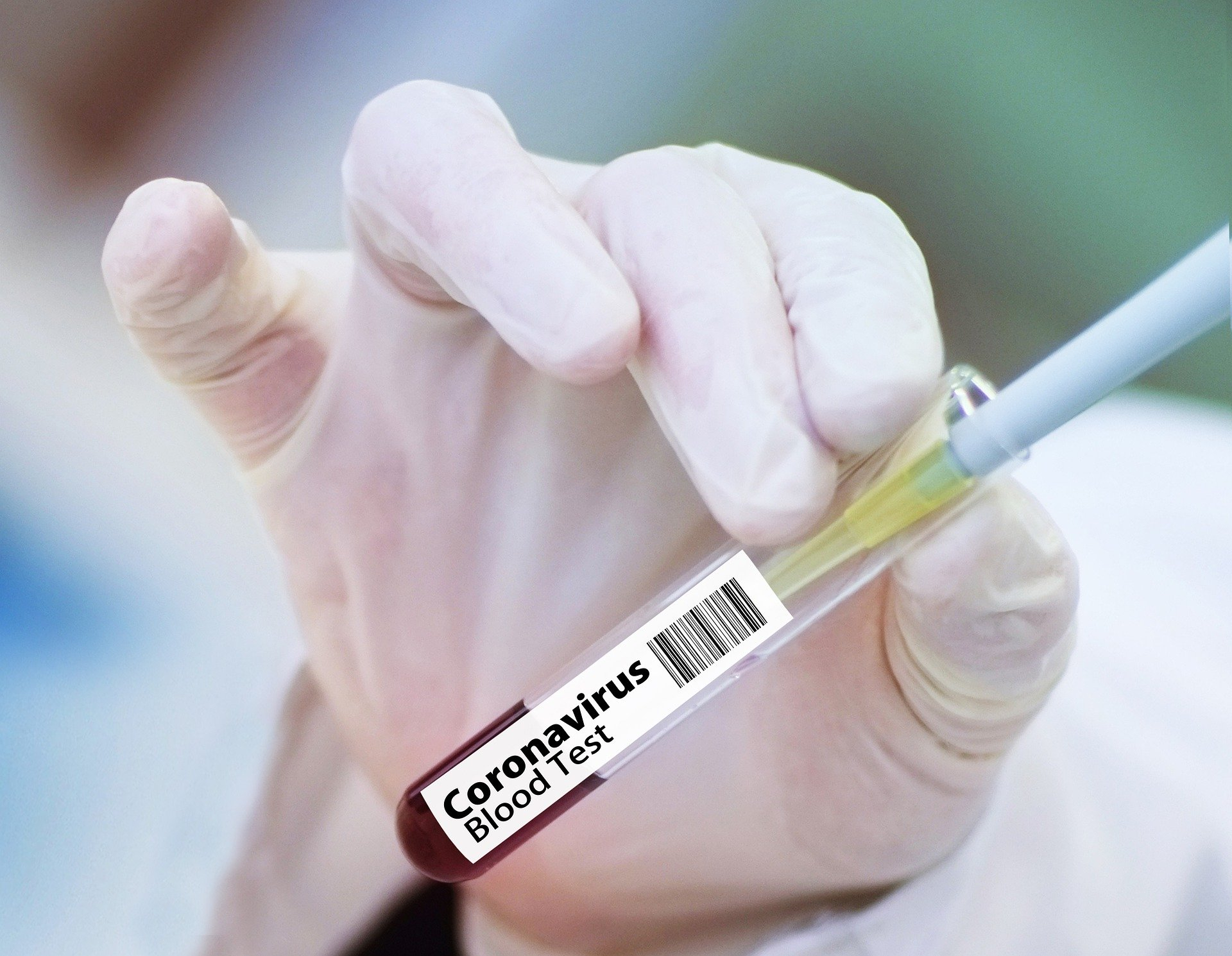 В Кировской области будут проверять тесты на коронавирус жителей Республики Коми