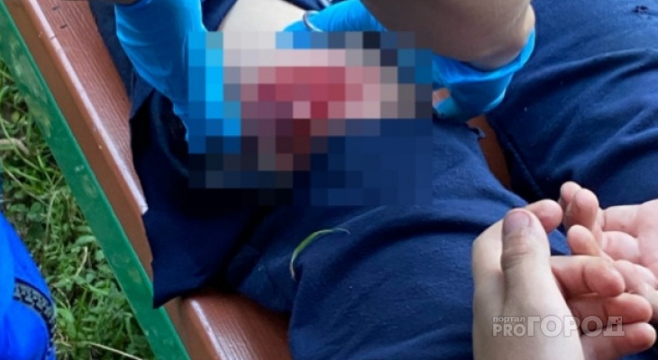 В Кирове ребенок травмировался железным штырем: прокуратура начала проверку