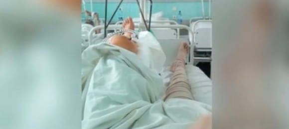 В Кирове мужчина получил двойной перелом после падения на улице