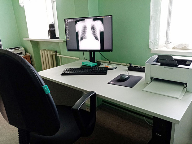 В Белохолуницком районе более 400 человек прошли обследование на флюорографе