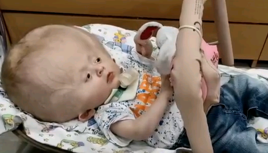 Немцы выделили 10 000 евро на пластику черепа для годовалого ребенка из Кирова