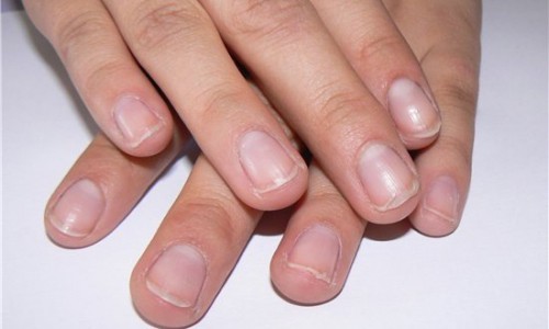 Наркоманов в Кирове будут выявлять по волосам и ногтям