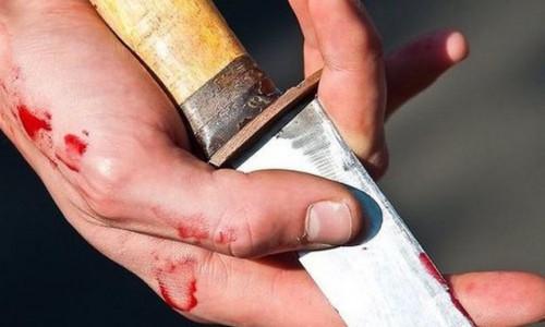 В Кировской области отец ударил сына самодельным ножом: тот умер в «скорой», не доехав до больницы