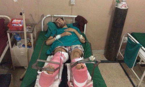 Кировчанина, разбившегося в Непале, не могут перевезти в российскую больницу для операции