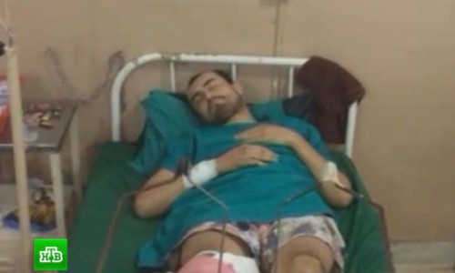 В Москве медики спасают жителя Кировской области, который раздробил ноги в Непале