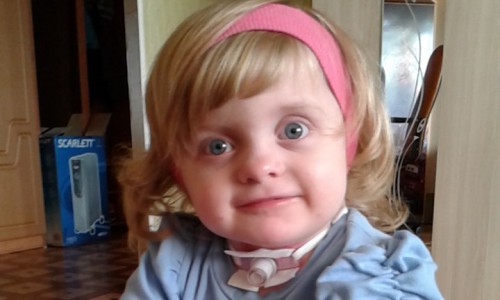 Малышка не может говорить и самостоятельно дышать: Полине стало хуже после очередной операции в Москве