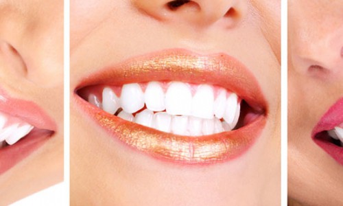 В чем секрет голливудской улыбки?