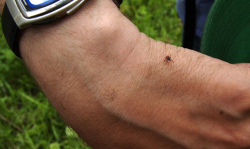 В Кировской области четыре человека умерли после укуса клещей