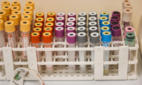 Кировская студентка нашла способ лечить рак дешевле