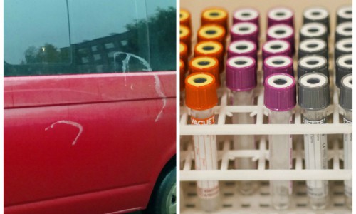 Что обсуждают утром: найден способ лечить рак дешевле и автомобиль, облитый кислотой