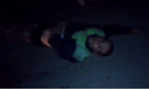 В Кировской области пьяный мотоциклист после ДТП впал в кому