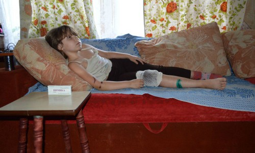 В Нововятске голодная собака едва не загрызла ребенка