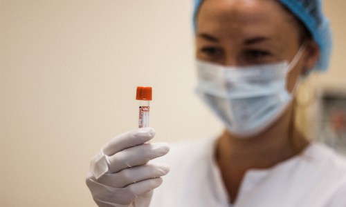 В Кирове за неделю СПИД обнаружили у 12 человек