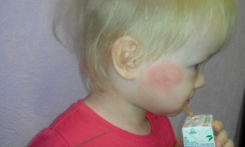 Кировчанка вынуждена продавать квартиру из-за зимней атаки комаров