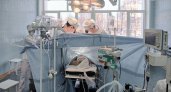 Врачи удалили у кировчанина огромную злокачественную опухоль на сердце