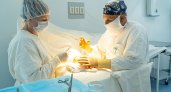 Кировские врачи достали из кисти пациента опухоль 