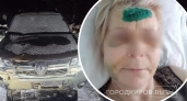 "Волок ее без сознания за капюшон": пьяный кировчанин сбил женщину и отделался лишением прав
