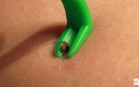 За неделю клещи покусали 14 кировчан