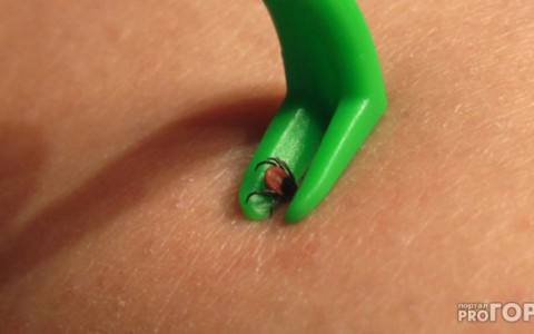 В Кировской области зафиксирован первый случай клещевого энцефалита