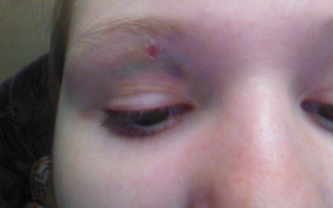 В Нововятске малолетние хулиганы закидали камнями девочку на улице