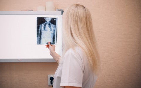 Кировчане смогут бесплатно и без направления сделать флюорографию