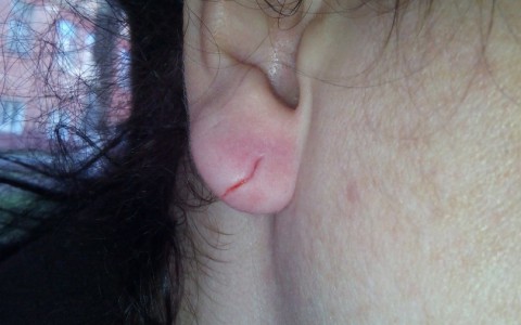 В кировском зоопарке страус порвал девушке ухо