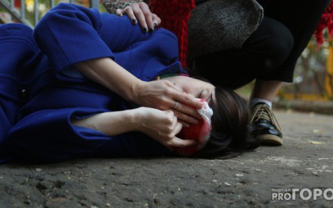 Подтвердилась информация о том, что кондуктору в Кирове откусили ухо