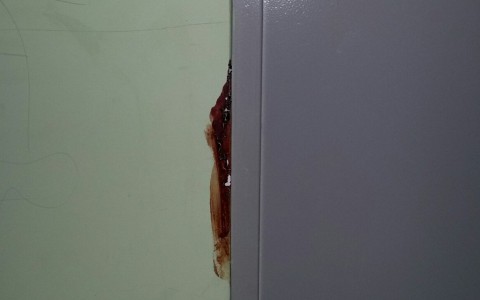 Лифт и стены в крови: что произошло в подъезде дома на Грибоедова?