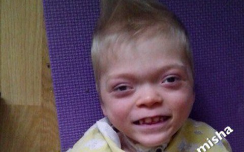 Московские врачи вернули 7-летнему мальчику из Кирова зрение