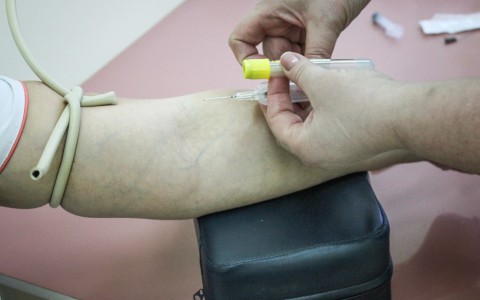 Кировчане могут бесплатно пройти тест на ВИЧ