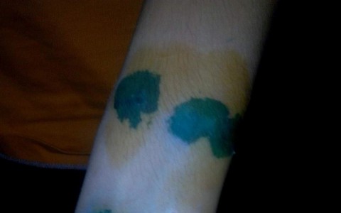 В Кировской области бездомная собака напала на школьников