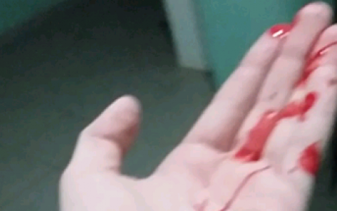 В Кирове мужчина пытался откусить соседке палец после просьбы не шуметь ночью